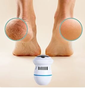 Pedispa™ - Votre solution ultime pour l'élimination des callosités