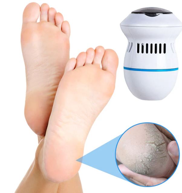 Pedispa™ - Votre solution ultime pour l'élimination des callosités