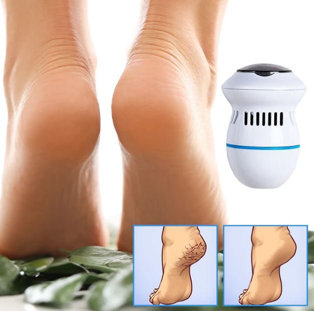 Pedispa™ - Votre solution ultime pour l'élimination des callosités