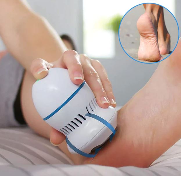 Pedispa™ - Votre solution ultime pour l'élimination des callosités